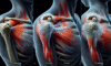 Acupuncture for Effective Relief from Frozen Shoulder Techniques